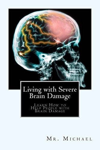 Cover of Living With Severe Brain Damage Learn How to Help People With Brain Damage