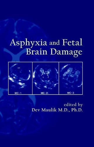 Cover of Asphyxia and Fetal Brain Damage