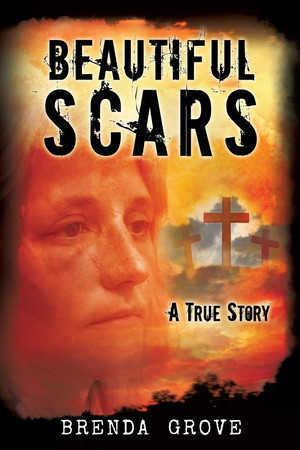 Cover of Beautiful Scars