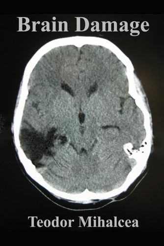Cover of Brain Damage