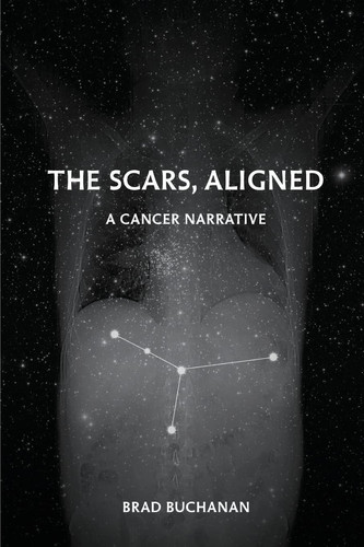 Cover of The Scars, Aligned