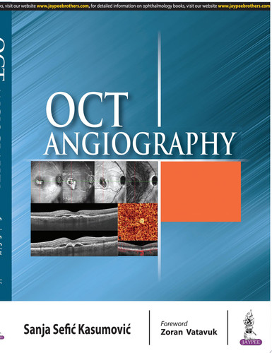 Cover of OCT Angiography